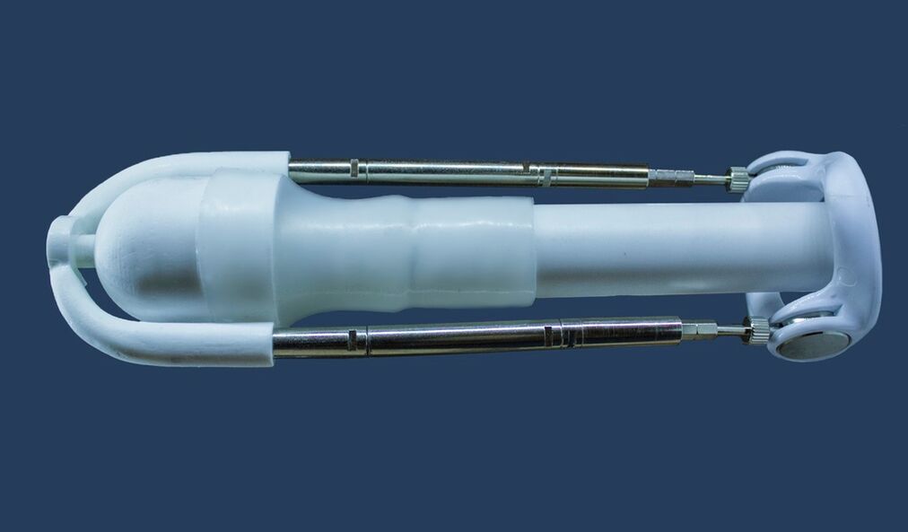 An extension is a device that increases the length of the male genital organ.