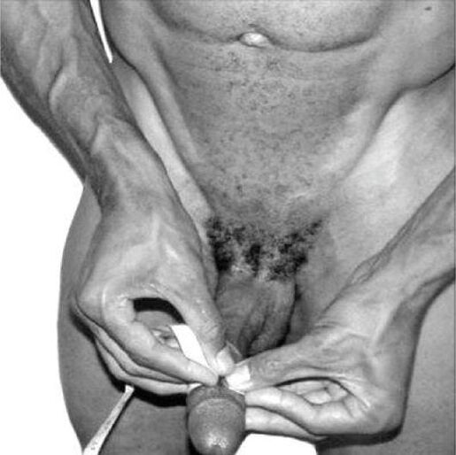 Penis measurement before enlargement