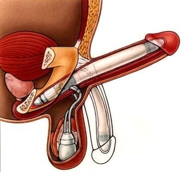 penile flexion for enlargement